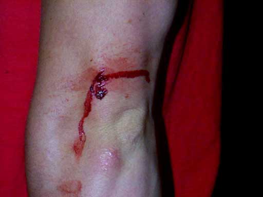blood
