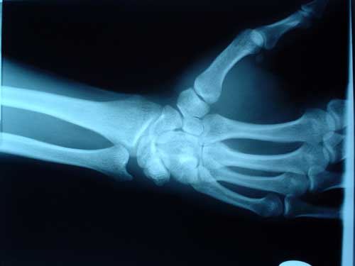 xray