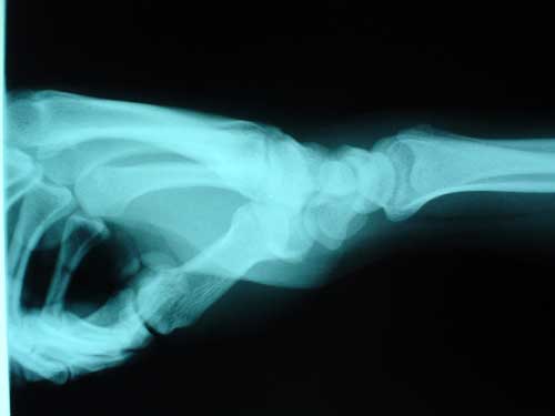 xray