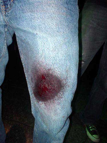 blood