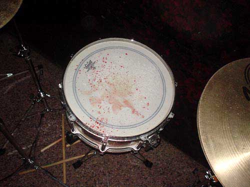 blood