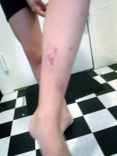 ouch