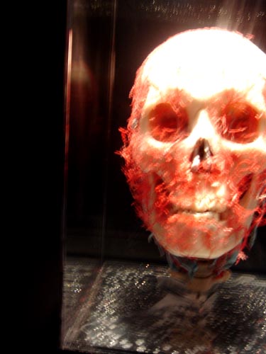 plastination