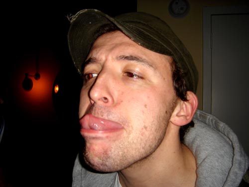 tongue