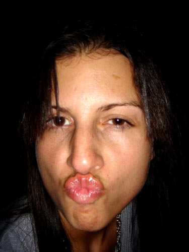 lips
