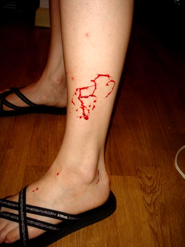 blood