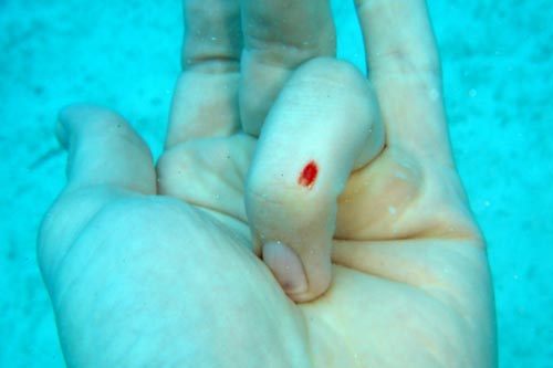 blood