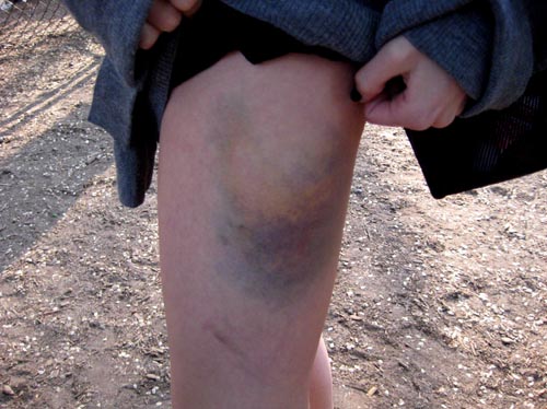 ouch