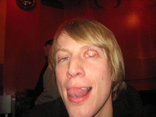 ugly face