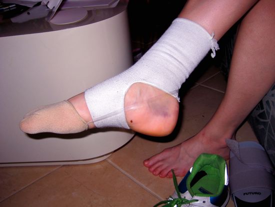 ouch