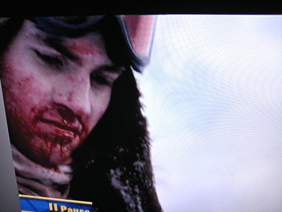 blood