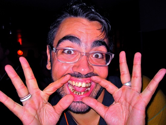 goldteeth