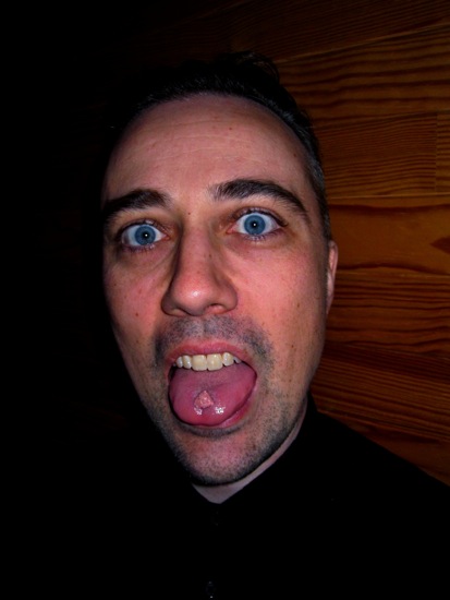 tongue
