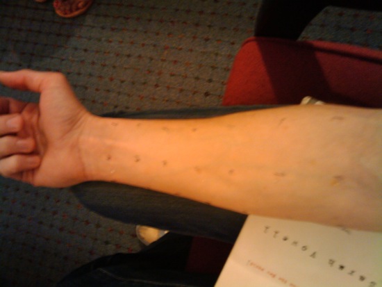arm