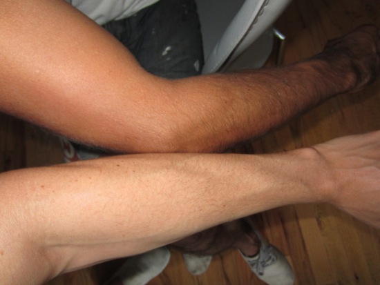 arm