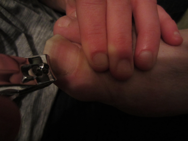 toe