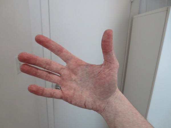hand