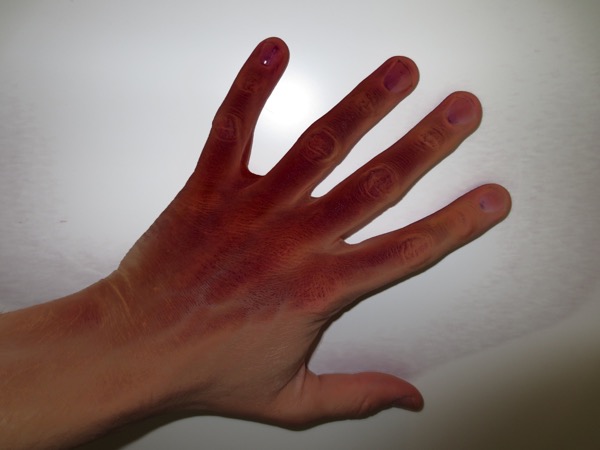 hand