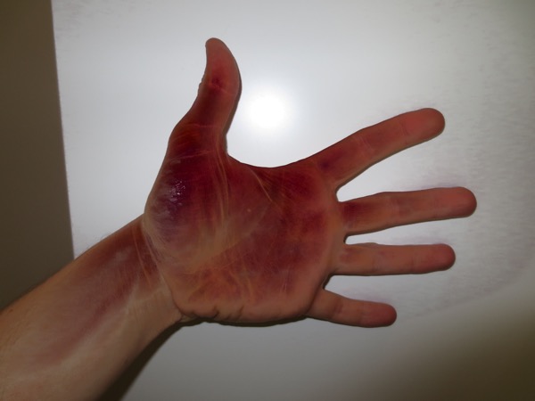 hand