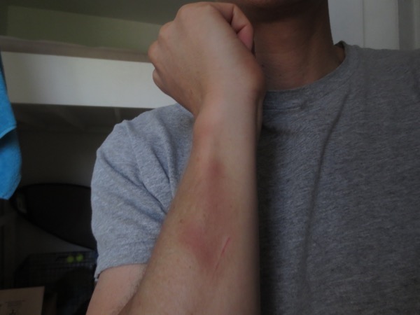 ouch