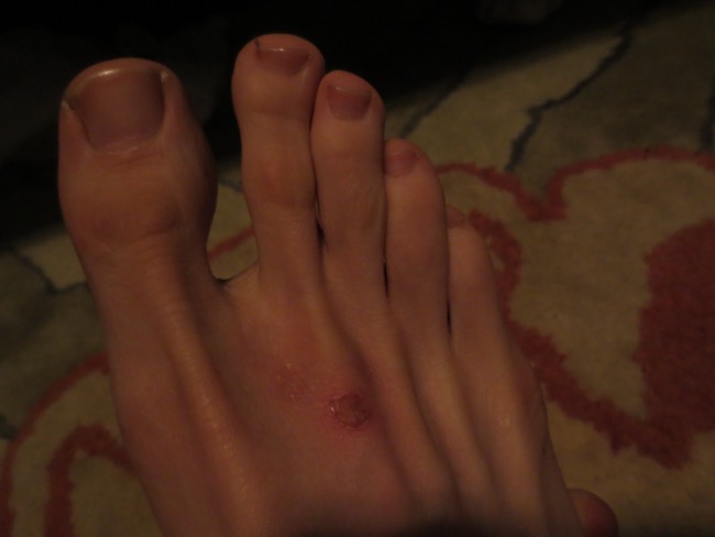 ouch