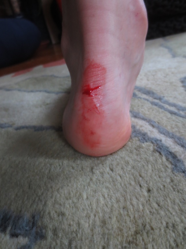 cut