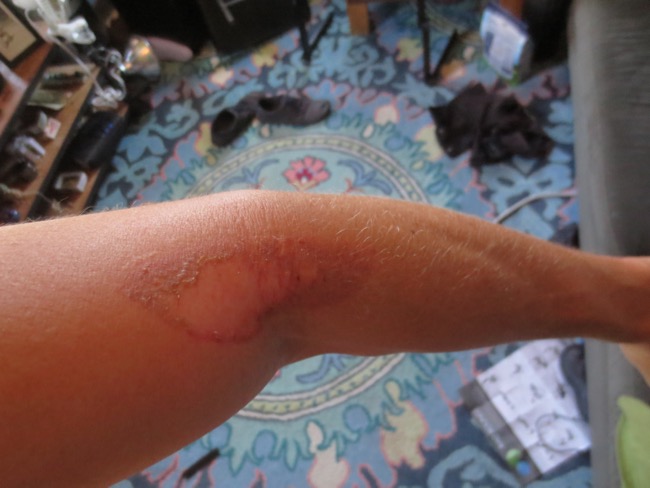 ouch