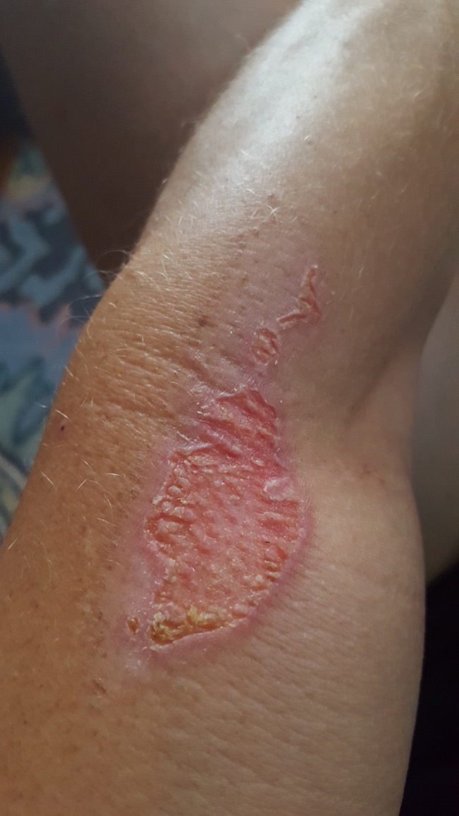 ouch